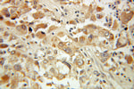 SAT1 Antibody in Immunohistochemistry (Paraffin) (IHC (P))