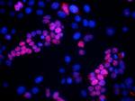SIX1 Antibody in Immunocytochemistry (ICC/IF)