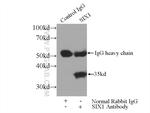 SIX1 Antibody in Immunoprecipitation (IP)