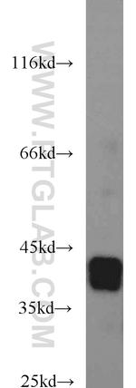 SIX1 Antibody in Western Blot (WB)