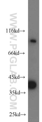 SIX1 Antibody in Western Blot (WB)