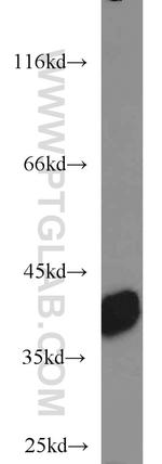 SIX1 Antibody in Western Blot (WB)