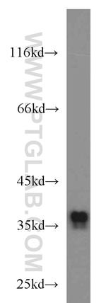 SIX1 Antibody in Western Blot (WB)
