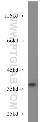 SIX1 Antibody in Western Blot (WB)