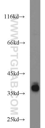 SIX1 Antibody in Western Blot (WB)