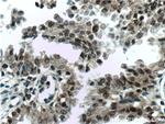 C1D Antibody in Immunohistochemistry (Paraffin) (IHC (P))