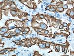 Cytokeratin 19 Antibody in Immunohistochemistry (Paraffin) (IHC (P))