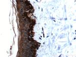 Cytokeratin 19 Antibody in Immunohistochemistry (Paraffin) (IHC (P))