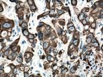 Cytokeratin 19 Antibody in Immunohistochemistry (Paraffin) (IHC (P))