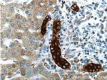 Cytokeratin 19 Antibody in Immunohistochemistry (Paraffin) (IHC (P))
