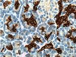 Cytokeratin 19 Antibody in Immunohistochemistry (Paraffin) (IHC (P))