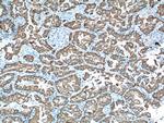 Cytokeratin 19 Antibody in Immunohistochemistry (Paraffin) (IHC (P))