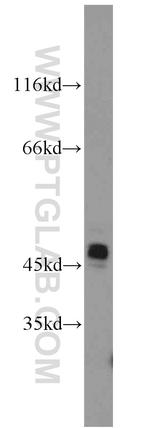 Cytokeratin 19 Antibody in Western Blot (WB)