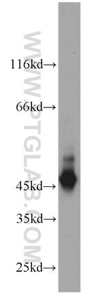 Cytokeratin 19 Antibody in Western Blot (WB)