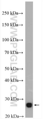 TPI1 Antibody in Western Blot (WB)