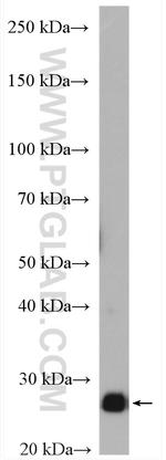 TPI1 Antibody in Western Blot (WB)
