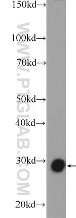 TPI1 Antibody in Western Blot (WB)
