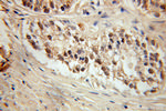 CGGBP1 Antibody in Immunohistochemistry (Paraffin) (IHC (P))