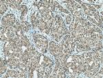 CGGBP1 Antibody in Immunohistochemistry (Paraffin) (IHC (P))