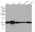 CGGBP1 Antibody in Western Blot (WB)