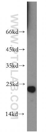 CGGBP1 Antibody in Western Blot (WB)