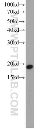 CGGBP1 Antibody in Western Blot (WB)