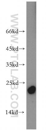 CGGBP1 Antibody in Western Blot (WB)