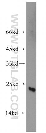 CGGBP1 Antibody in Western Blot (WB)