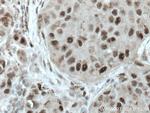 Cyclin H Antibody in Immunohistochemistry (Paraffin) (IHC (P))