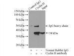 Cyclin H Antibody in Immunoprecipitation (IP)