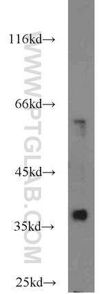 Cyclin H Antibody in Western Blot (WB)