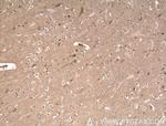 EPB41L3 Antibody in Immunohistochemistry (Paraffin) (IHC (P))