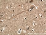 EPB41L3 Antibody in Immunohistochemistry (Paraffin) (IHC (P))