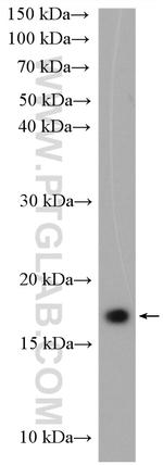 UBE2G2 Antibody in Western Blot (WB)