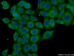 NRAS Antibody in Immunocytochemistry (ICC/IF)