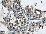 NRAS Antibody in Immunohistochemistry (Paraffin) (IHC (P))