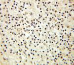 SERBP1 Antibody in Immunohistochemistry (Paraffin) (IHC (P))