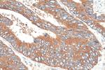 SERBP1 Antibody in Immunohistochemistry (Paraffin) (IHC (P))