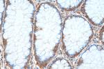 SERBP1 Antibody in Immunohistochemistry (Paraffin) (IHC (P))