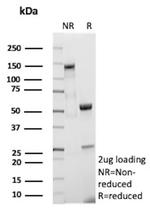 CFL2/NEM7 Antibody in SDS-PAGE (SDS-PAGE)