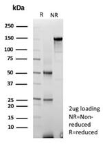 CFL2/NEM7 Antibody in SDS-PAGE (SDS-PAGE)
