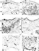 S100A10 Antibody in Immunohistochemistry (IHC)