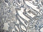 TPM3 Antibody in Immunohistochemistry (Paraffin) (IHC (P))