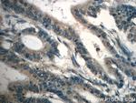 TPM3 Antibody in Immunohistochemistry (Paraffin) (IHC (P))