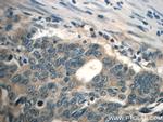 TPM3 Antibody in Immunohistochemistry (Paraffin) (IHC (P))