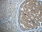 TPM3 Antibody in Immunohistochemistry (Paraffin) (IHC (P))