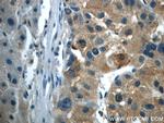TPM3 Antibody in Immunohistochemistry (Paraffin) (IHC (P))