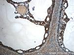 TPM3 Antibody in Immunohistochemistry (Paraffin) (IHC (P))