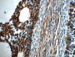 TPM3 Antibody in Immunohistochemistry (Paraffin) (IHC (P))