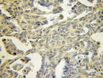 TPM3 Antibody in Immunohistochemistry (Paraffin) (IHC (P))